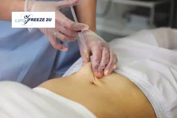 How Does Aqualyx Fat Dissolving Injection Work to Break Down Fat Wigan?