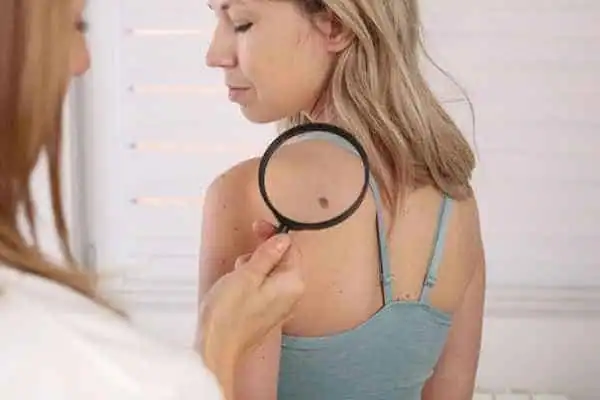 A side-by-side infographic comparing CryoPen cryotherapy with electrosurgery, highlighting differences in invasiveness, pain, and recovery Wigan