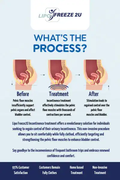 Diagram of how incontinence treatment Wigan works.