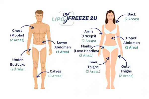 Areas you can have fat freezing treatment Wigan