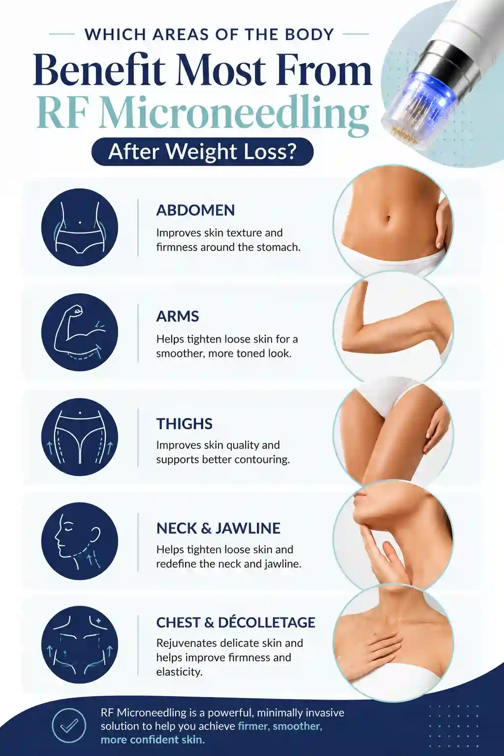 Which Areas of the Body Benefit Most From RF Microneedling After Weight Loss Wigan